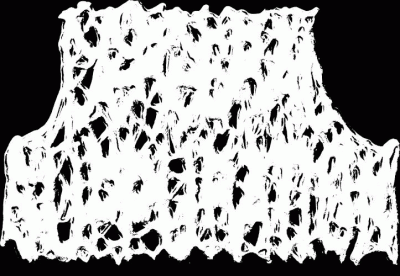 logo Cerebral Suppuration